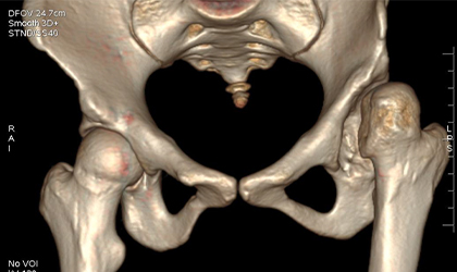 Pre-Surgery Assessment